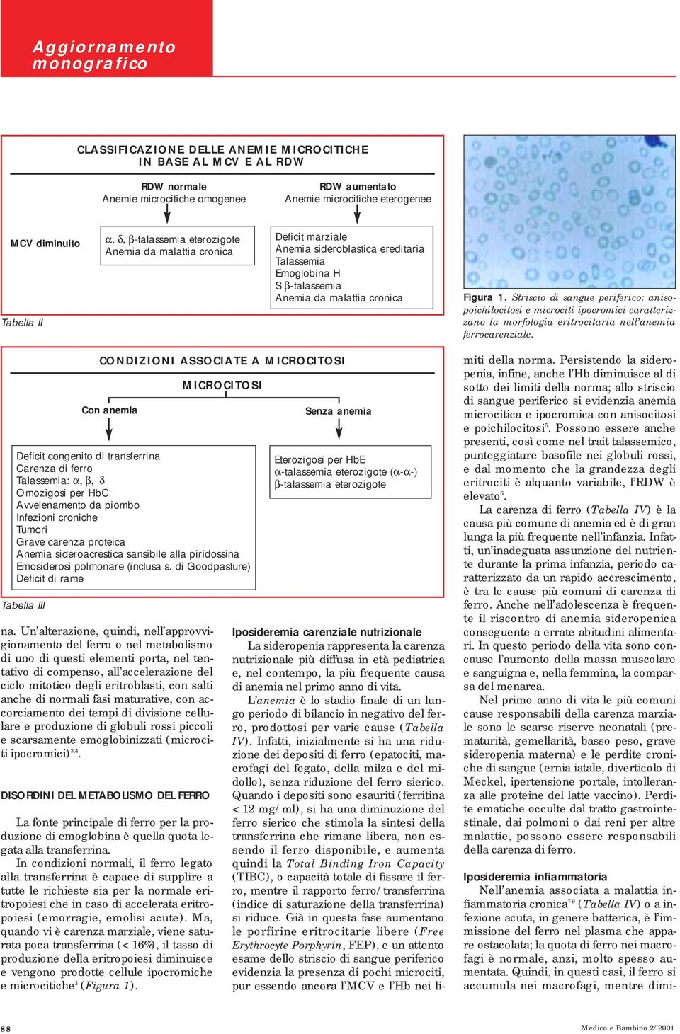 Striscio di sangue periferico: anisopoichilocitosi e microciti ipocromici caratterizzano la morfologia eritrocitaria nell anemia ferrocarenziale.