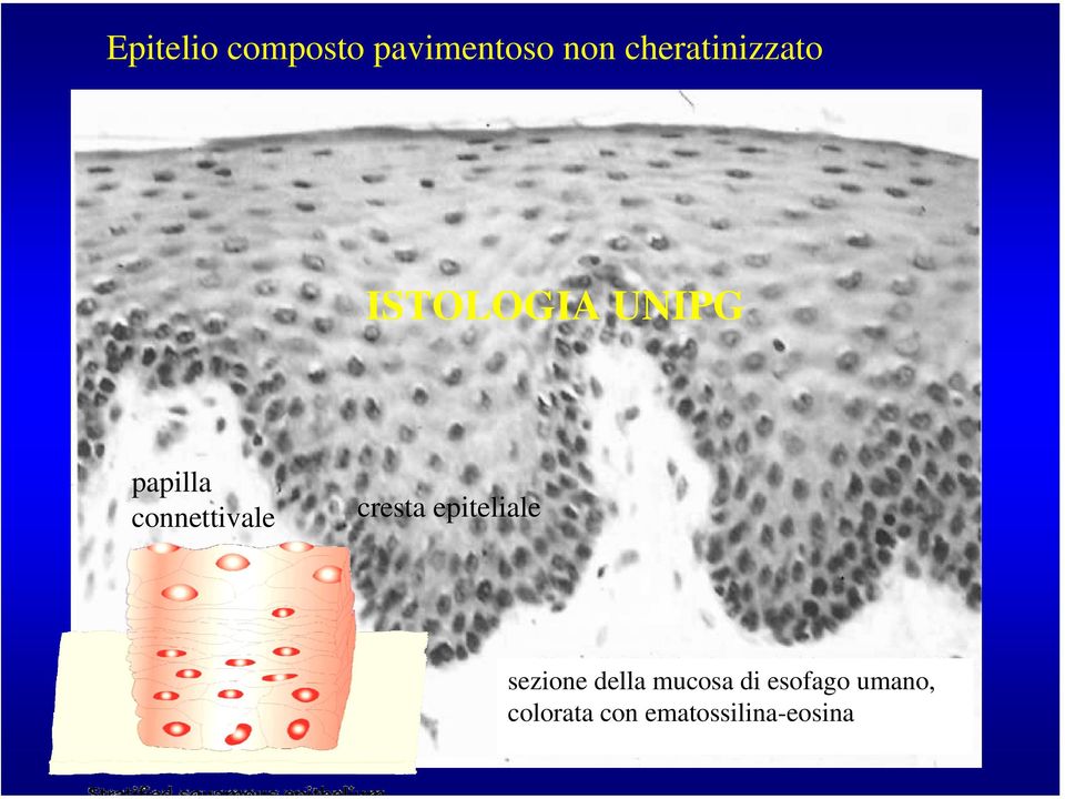 cresta epiteliale sezione della mucosa