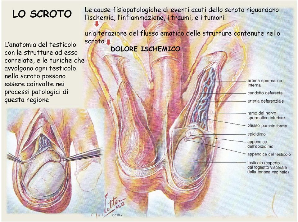 un alterazione del flusso ematico delle strutture contenute nello scroto DOLORE ISCHEMICO L