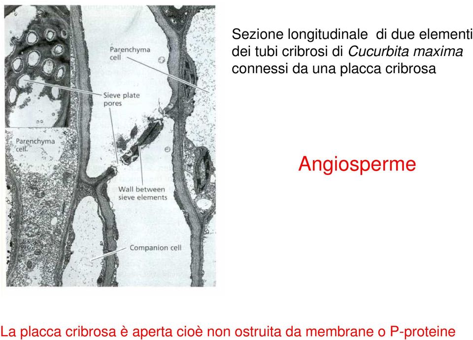 placca cribrosa Angiosperme La placca cribrosa