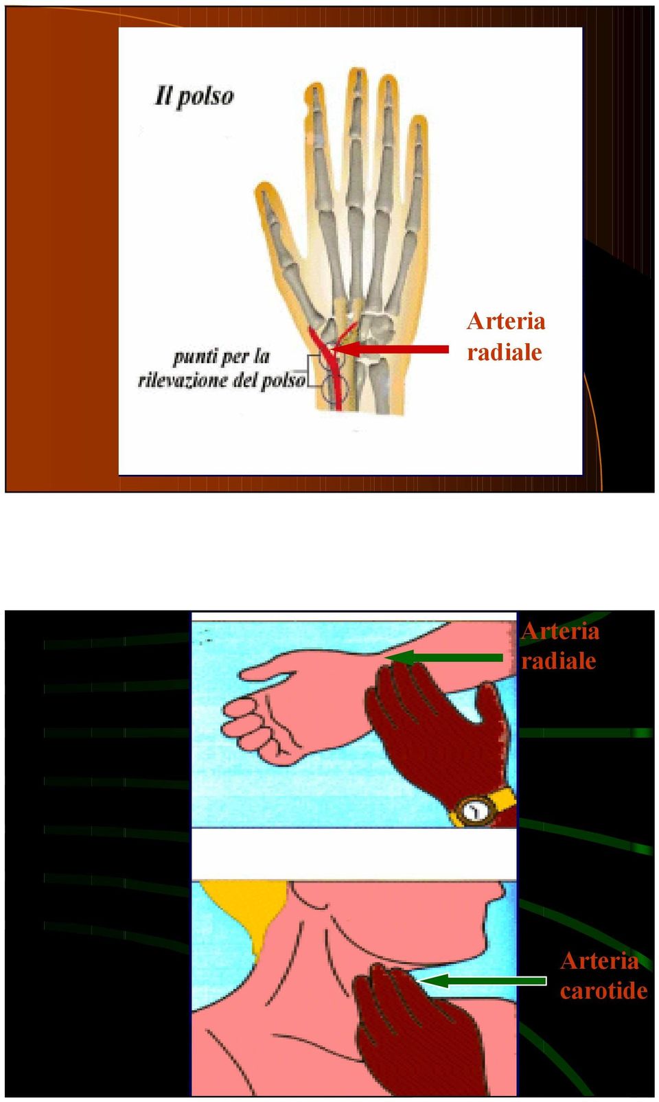 carotide