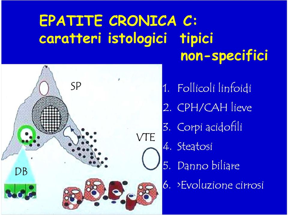 Follicoli linfoidi 2. CPH/CAH lieve VTE 3.