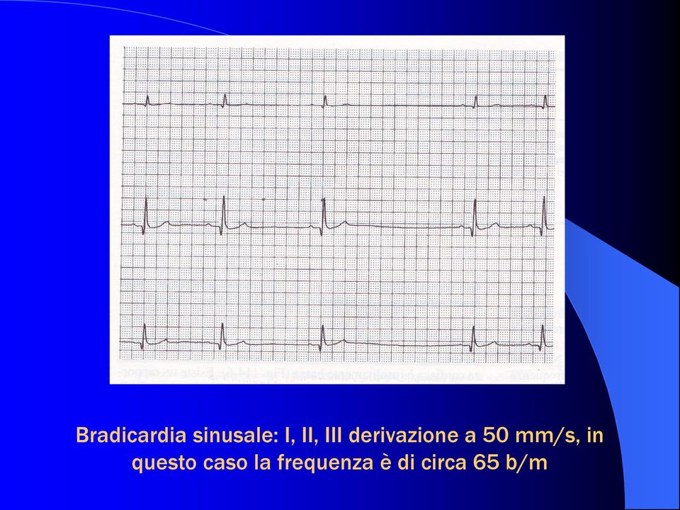 mm/s, in questo caso la