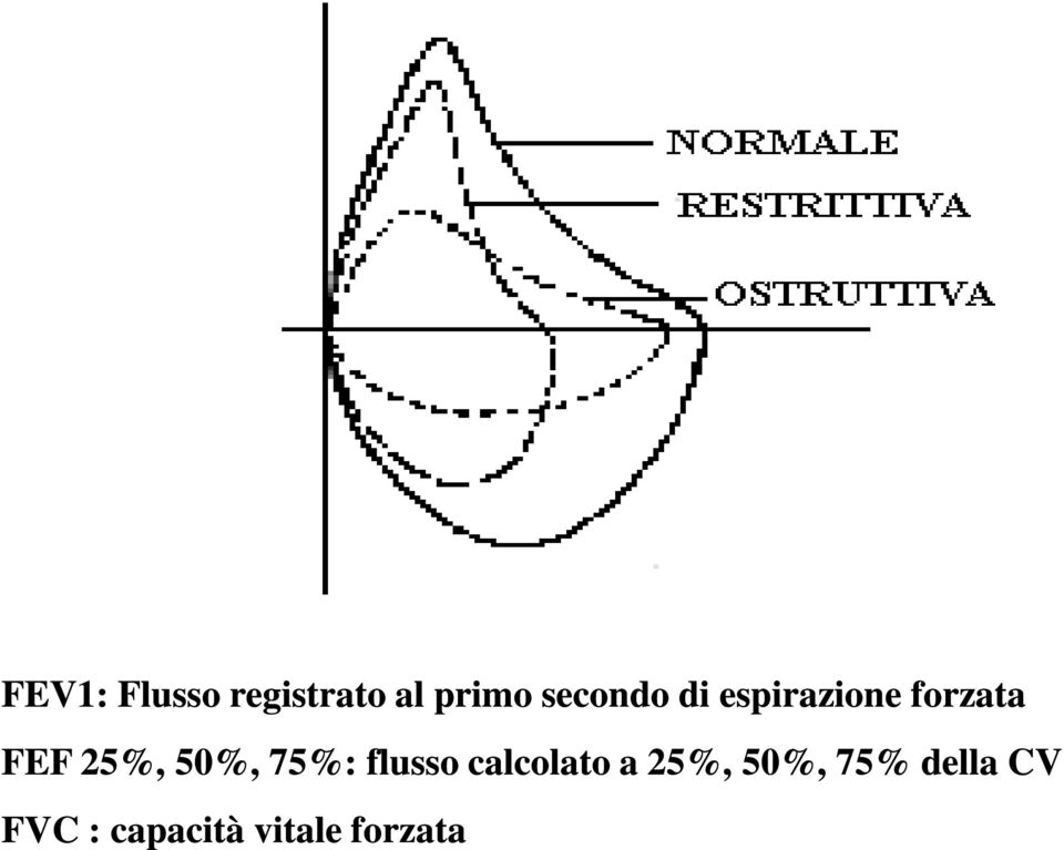 25%, 50%, 75%: flusso calcolato a 25%,