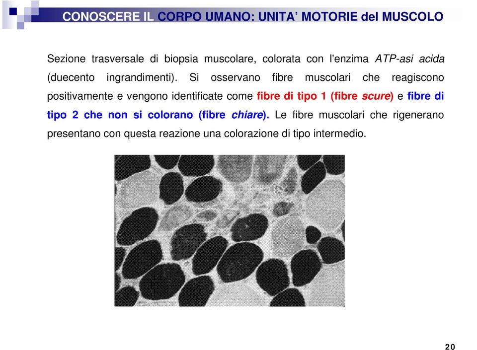 Si osservano fibre muscolari che reagiscono positivamente e vengono identificate come fibre di tipo 1