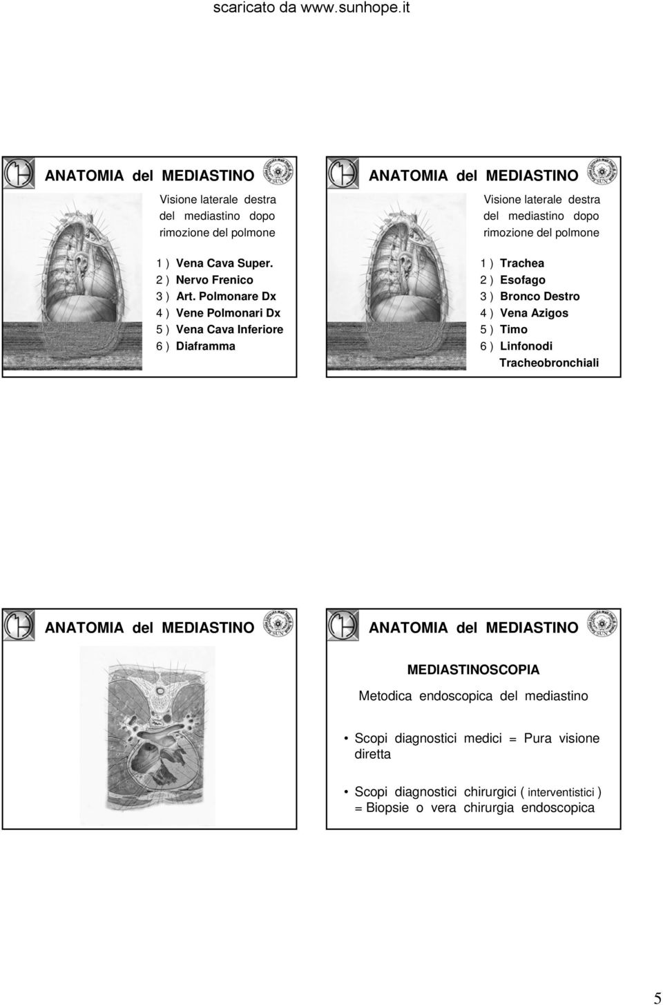 ) Esofago 3 ) Bronco Destro 4 ) Vena Azigos 5 ) Timo 6 ) Linfonodi Tracheobronchiali Metodica endoscopica del