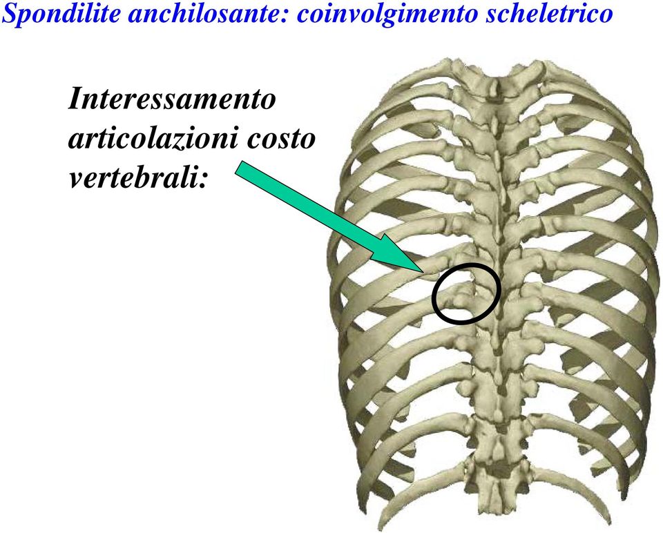 costo vertebrali: Limitazione dell