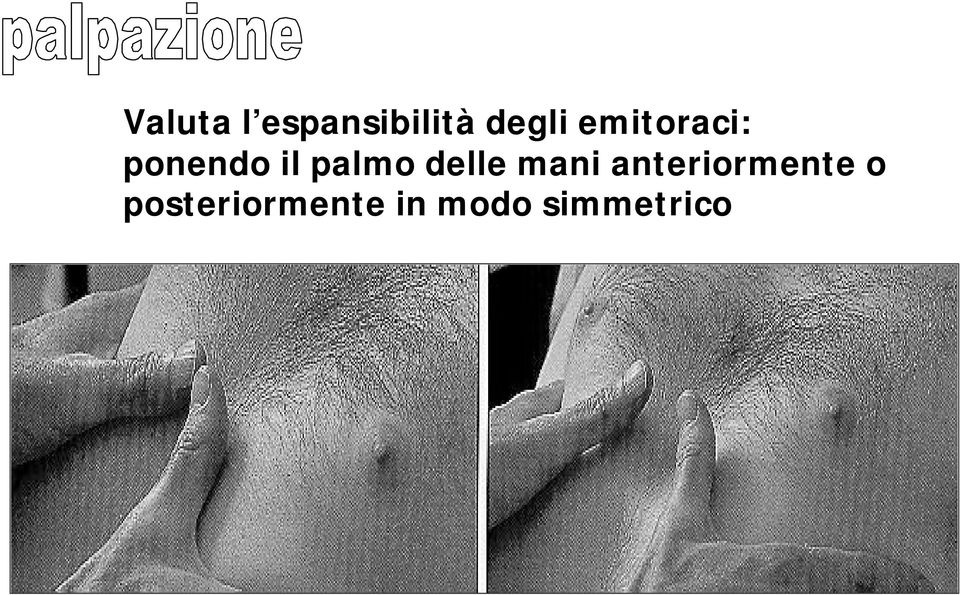 delle mani anteriormente o