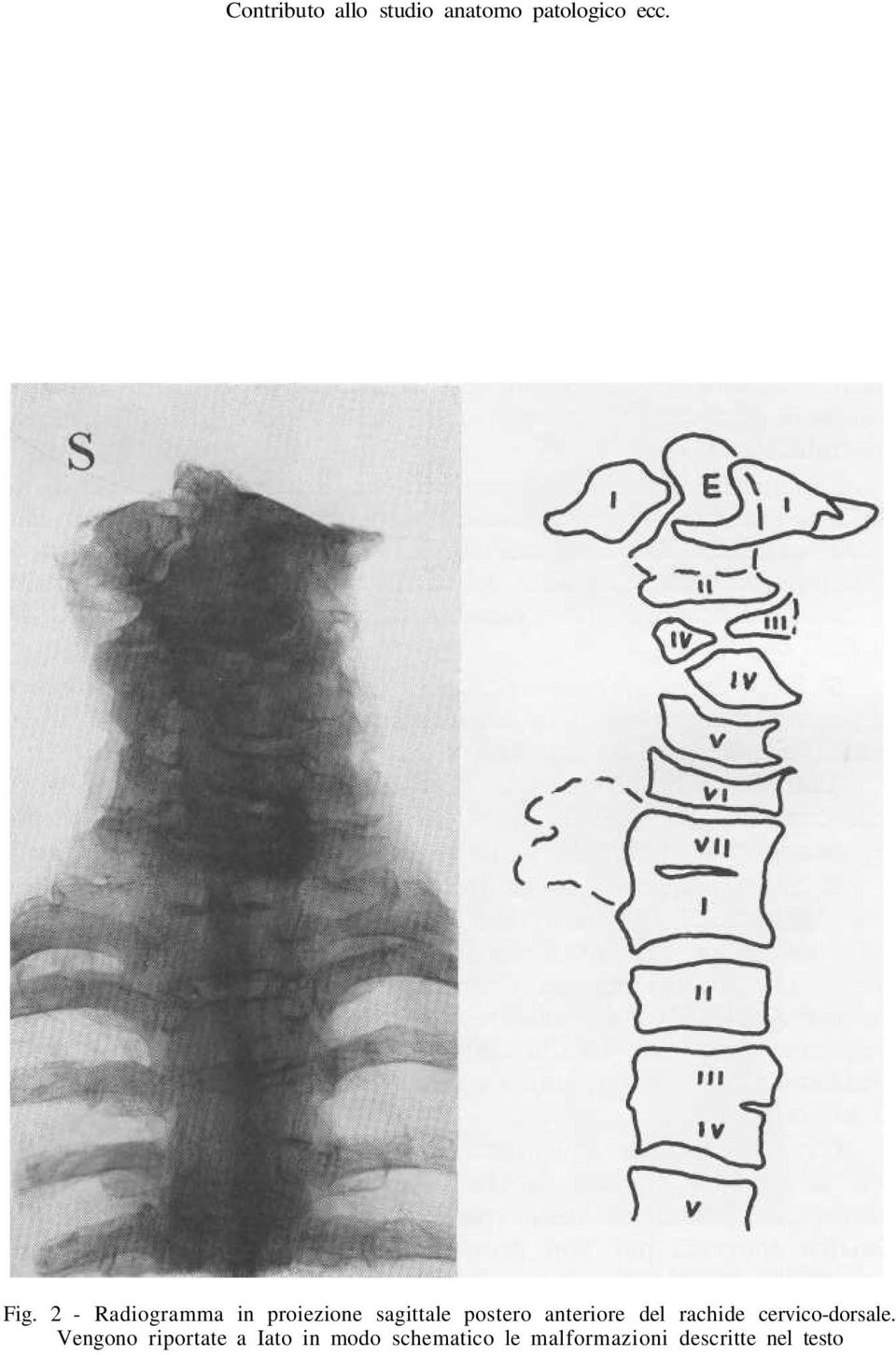 anteriore del rachide cervico-dorsale.