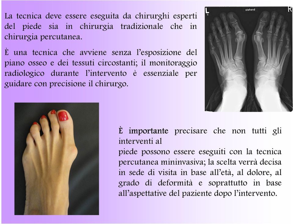 essenziale per guidare con precisione il chirurgo.