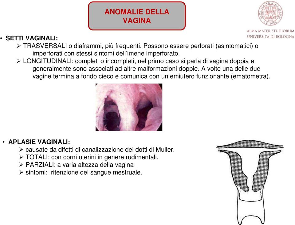 LONGITUDINALI: completi o incompleti, nel primo caso si parla di vagina doppia e generalmente sono associati ad altre malformazioni doppie.