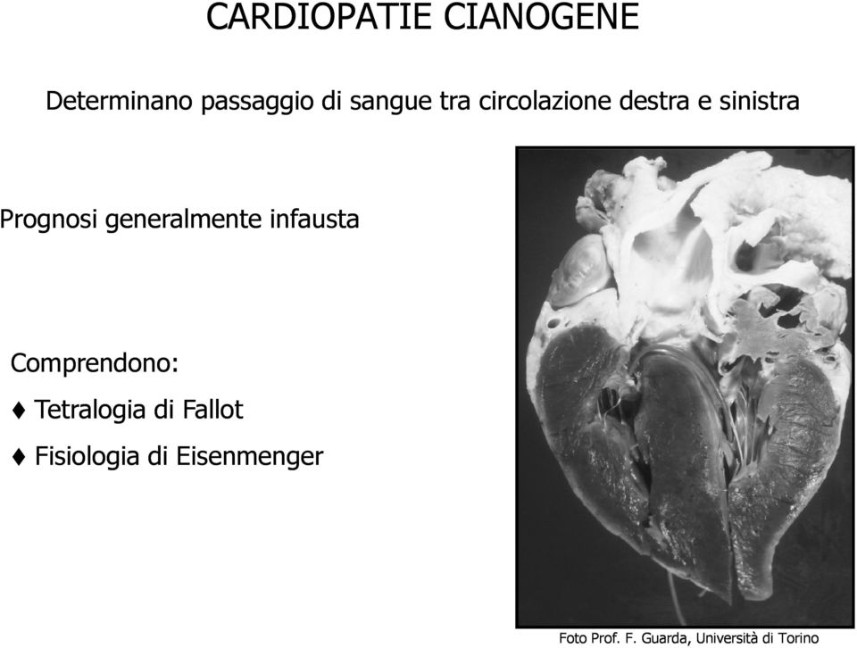 generalmente infausta Comprendono: Tetralogia di Fallot