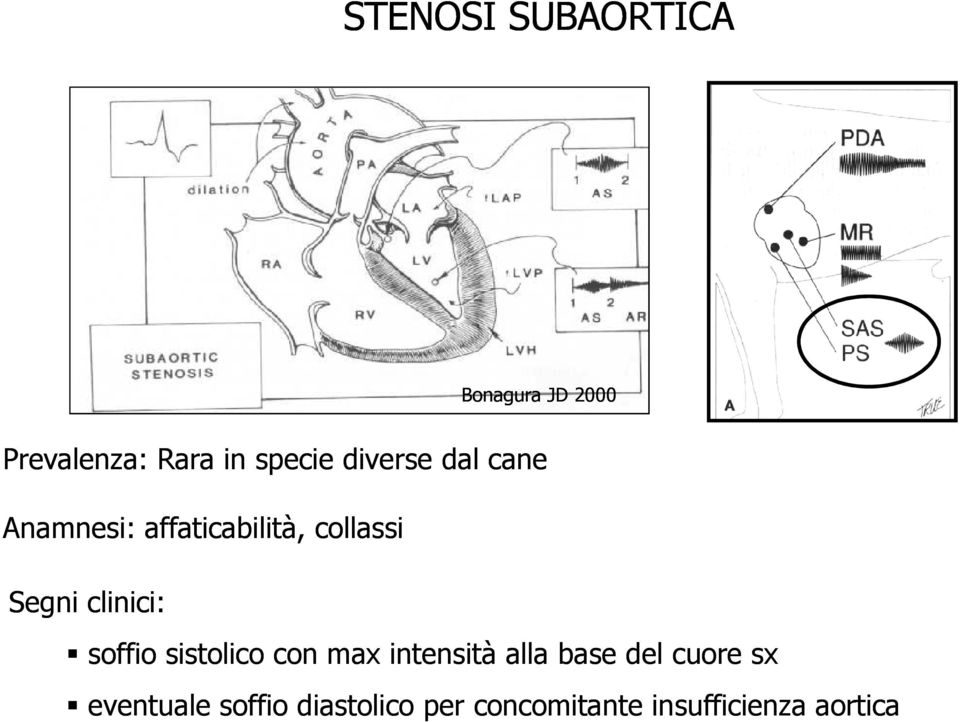 clinici: soffio sistolico con max intensità alla base del cuore