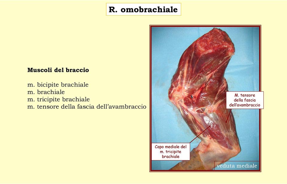 tensore della fascia dell avambraccio M.