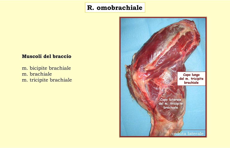 brachiale m.