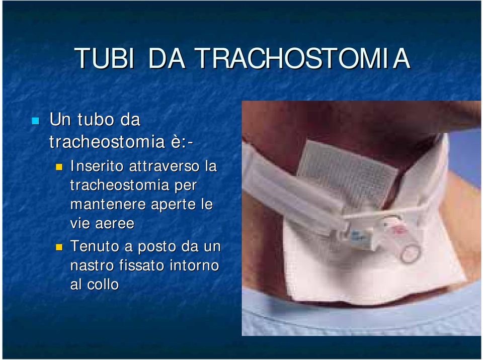 tracheostomia per mantenere aperte le vie