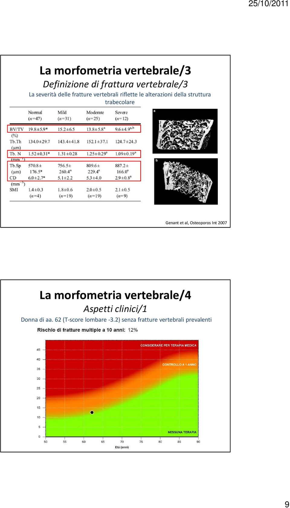 Genant et al, Osteoporos Int 2007 La morfometria vertebrale/4 Aspetti