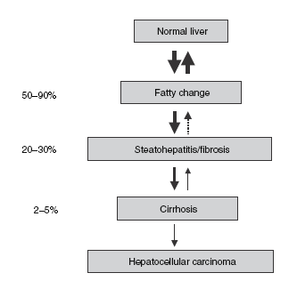 Non-alcoholic fatty liver disease Comprende uno spettro di lesioni molto simili a quelle alcoliche