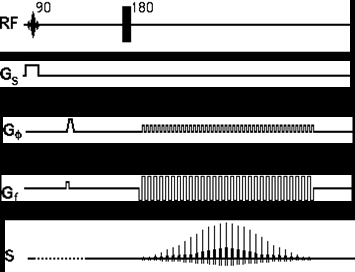 Sequenze ultra rapide: EPI (Echo Planar Imaging) Diagramma temporale C'è un impulso RF a 90 che viene applicato insieme ad un gradiente di selezione della fetta.