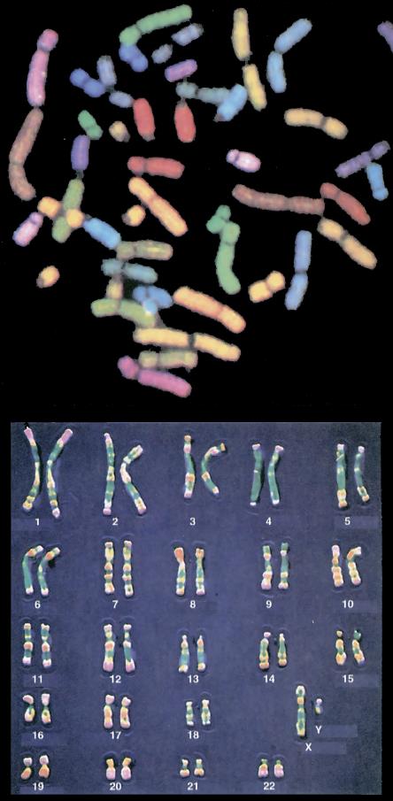 cromatina si condensa in