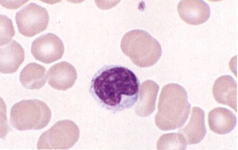 Linfociti Nuclei caratteristici Globuli bianchi più piccoli Nucleo rotondo e denso Citoplasma scarso