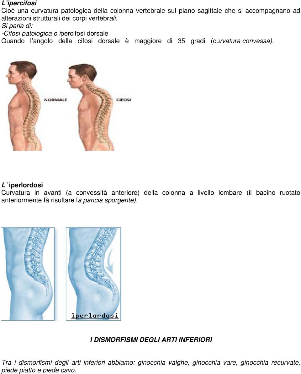 L iperlordosi Curvatura in avanti (a convessità anteriore) della colonna a livello lombare (il bacino ruotato anteriormente fà risultare la pancia