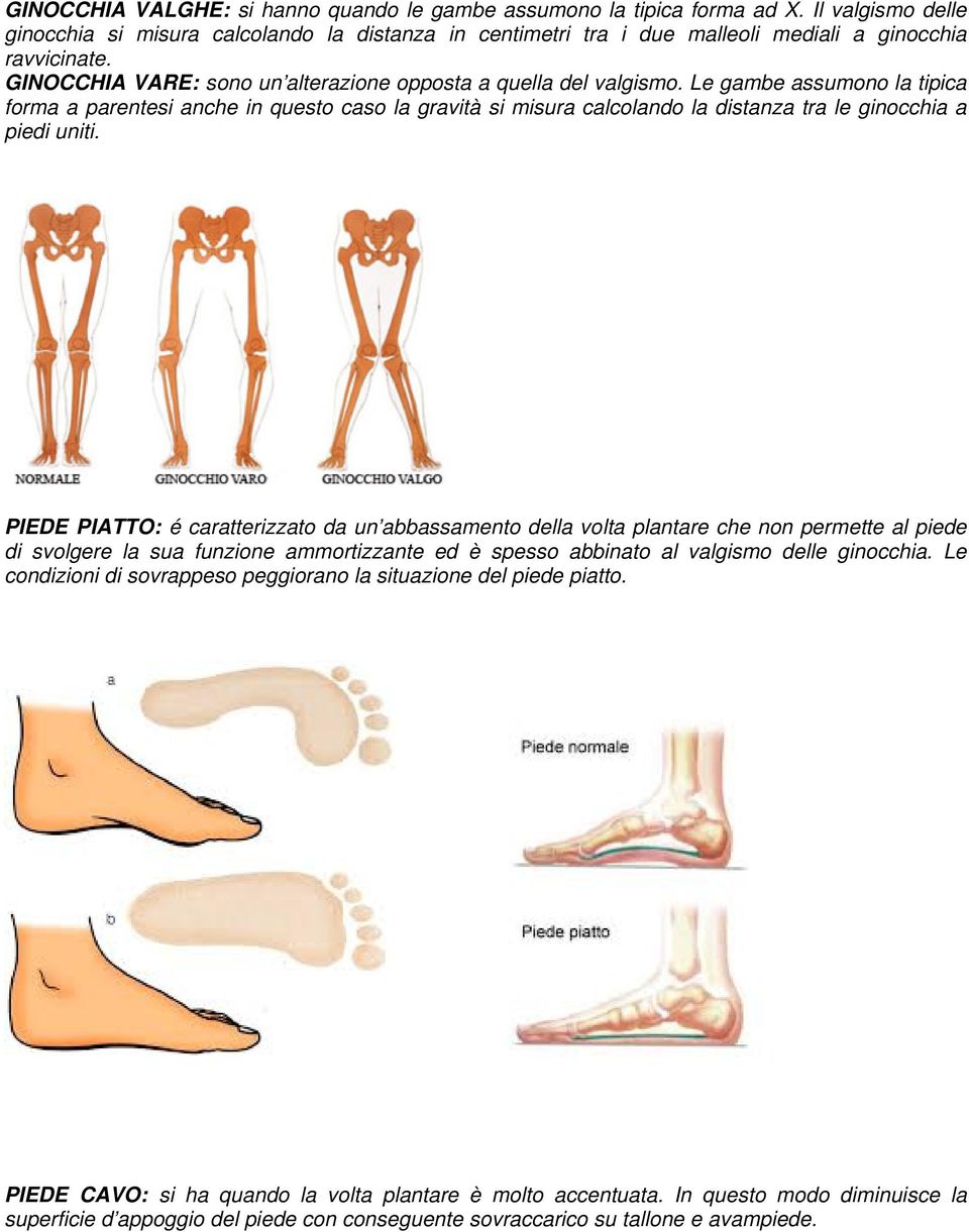 Le gambe assumono la tipica forma a parentesi anche in questo caso la gravità si misura calcolando la distanza tra le ginocchia a piedi uniti.