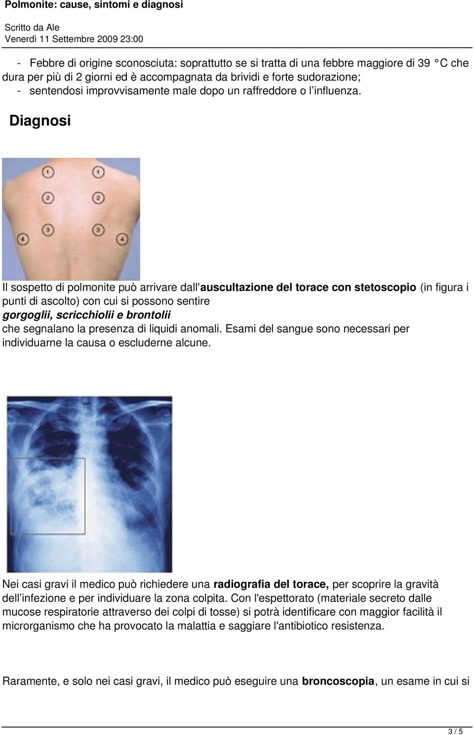 Diagnosi Il sospetto di polmonite può arrivare dall'auscultazione del torace con stetoscopio (in figura i punti di ascolto) con cui si possono sentire gorgoglii, scricchiolii e brontolii che