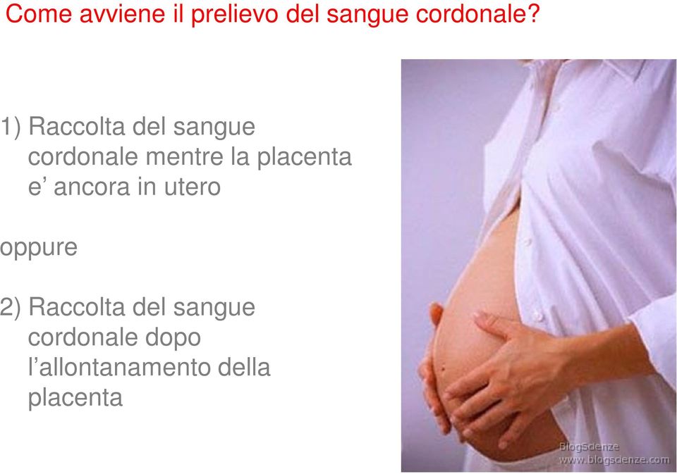 placenta e ancora in utero oppure 2) Raccolta