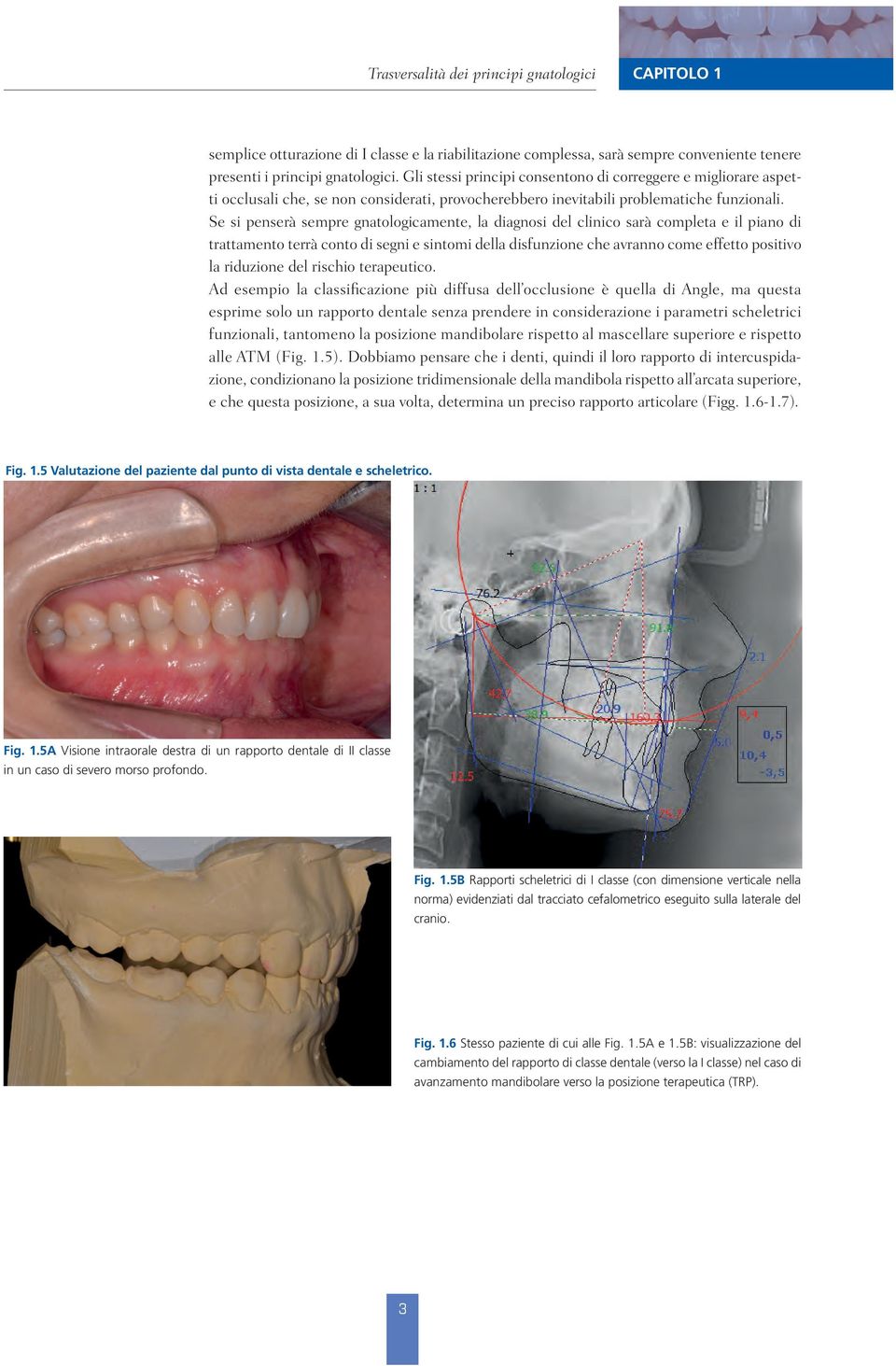 Se si penserà sempre gnatologicamente, la diagnosi del clinico sarà completa e il piano di trattamento terrà conto di segni e sintomi della disfunzione che avranno come effetto positivo la riduzione