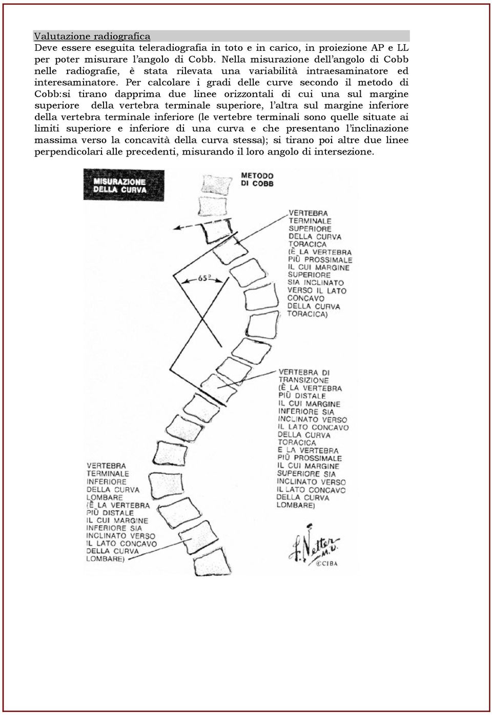 Per calcolare i gradi delle curve secondo il metodo di Cobb:si tirano dapprima due linee orizzontali di cui una sul margine superiore della vertebra terminale superiore, l altra sul margine