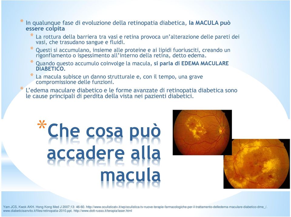 * Quando questo accumulo coinvolge la macula, si parla di EDEMA MACULARE DIABETICO. * La macula subisce un danno strutturale e, con il tempo, una grave compromissione delle funzioni.