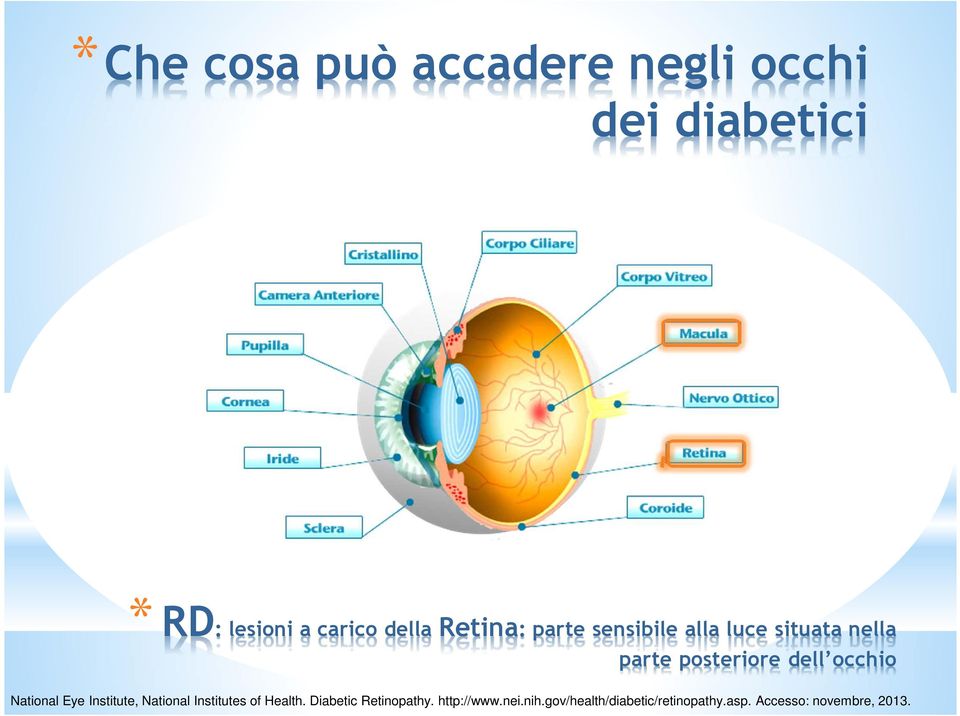 National Eye Institute, National Institutes of Health. Diabetic Retinopathy.