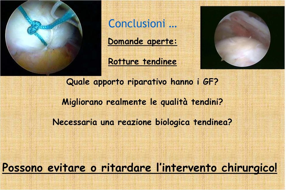 Migliorano realmente le qualità tendini?