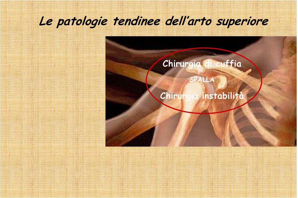 Chirurgia di cuffia