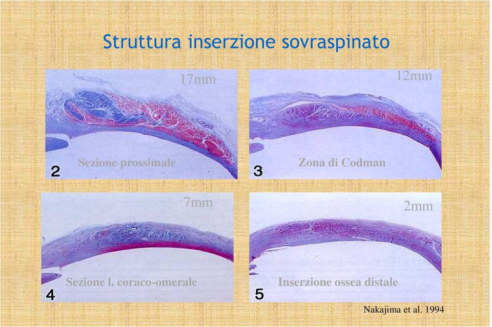 7mm 2mm Sezione l.