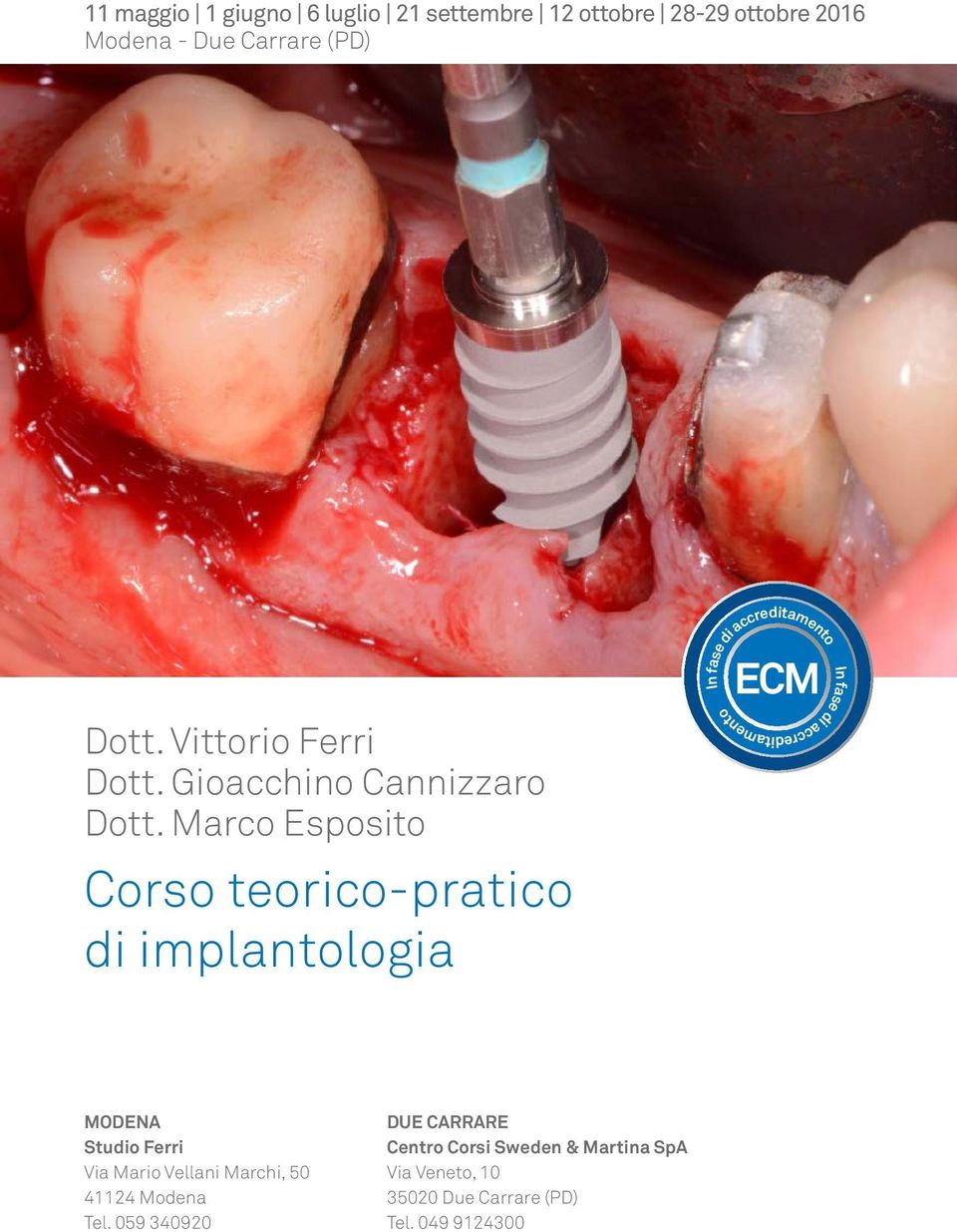 Marco Esposito Corso teorico-pratico di implantologia MODENA Studio Ferri Via Mario Vellani Marchi, 50 41124