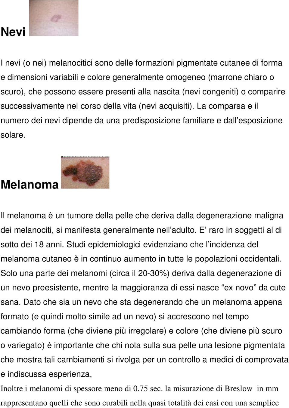 Melanoma Il melanoma è un tumore della pelle che deriva dalla degenerazione maligna dei melanociti, si manifesta generalmente nell adulto. E raro in soggetti al di sotto dei 18 anni.