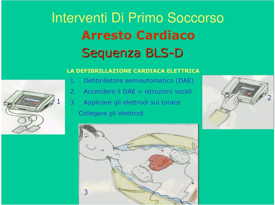 Defibrillatore semiautomatico (DAE) 1 2.