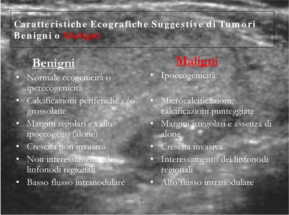 interessamento dei linfonodi regionali Basso flusso intranodulare Maligni Ipoecogenicità Microcalcificazioni,