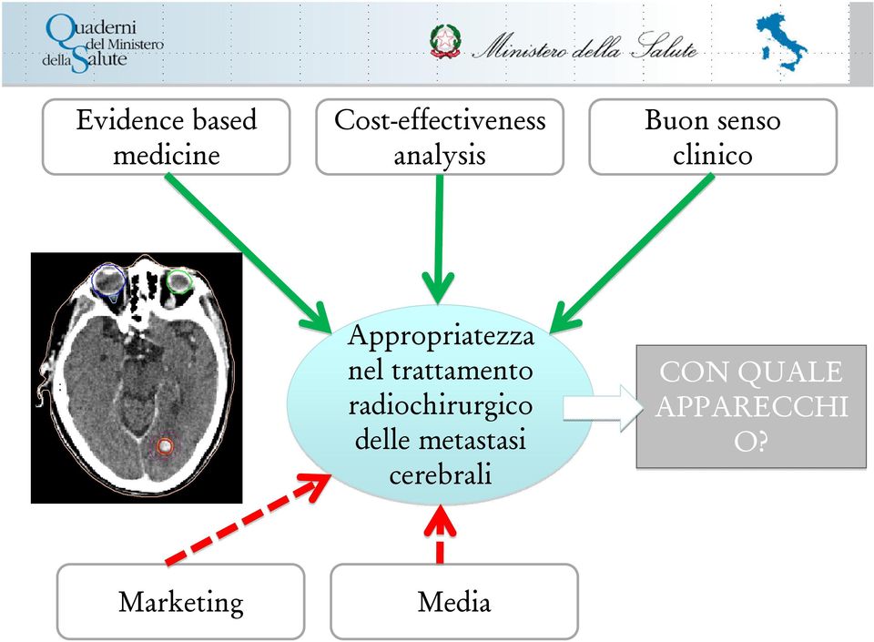 nel trattamento radiochirurgico delle