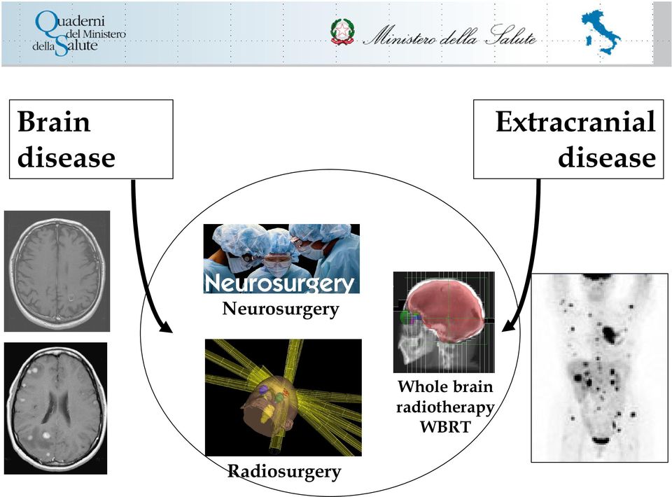 Neurosurgery Whole