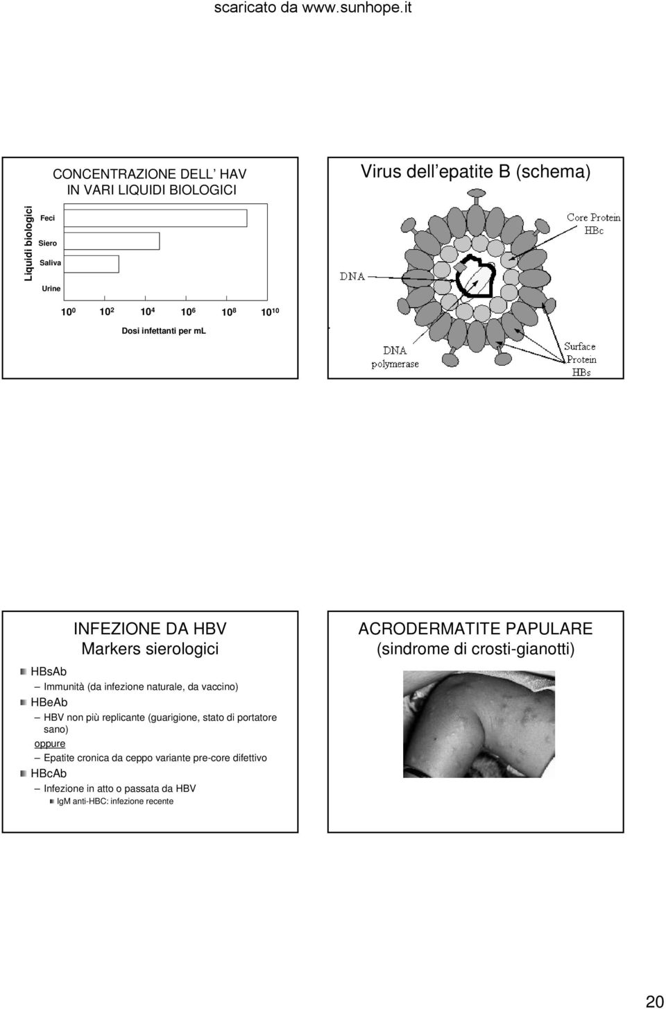 vaccino) HBeAb HBV non più replicante (guarigione, stato di portatore sano) oppure Epatite cronica da ceppo variante precore