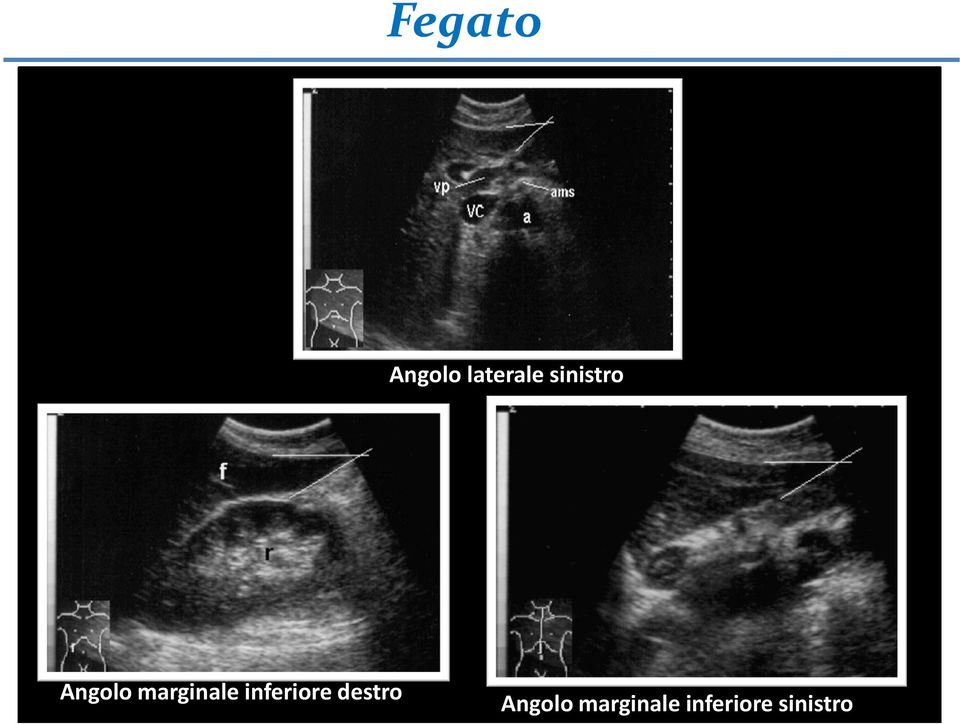 inferiore destro Angolo