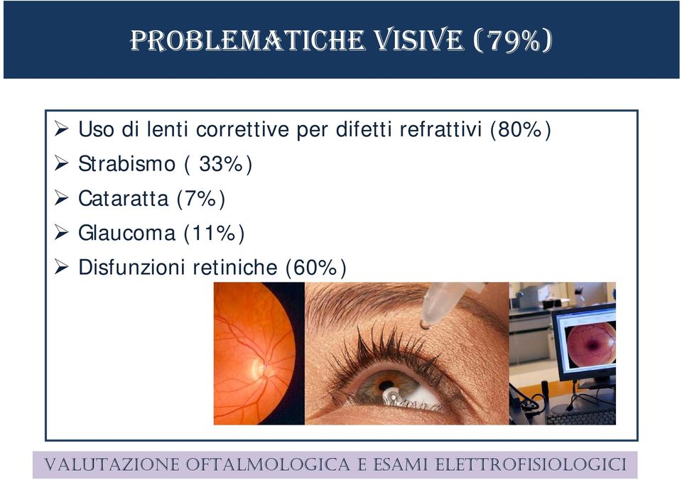 Cataratta (7%) Glaucoma (11%) Disfunzioni retiniche