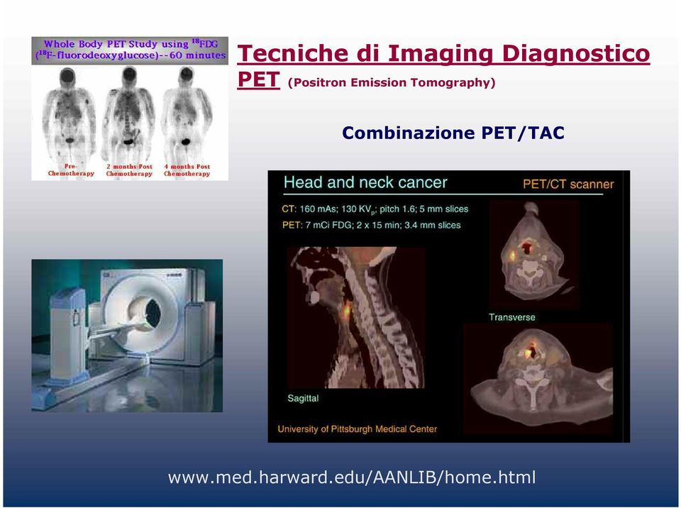 Emission Tomography)