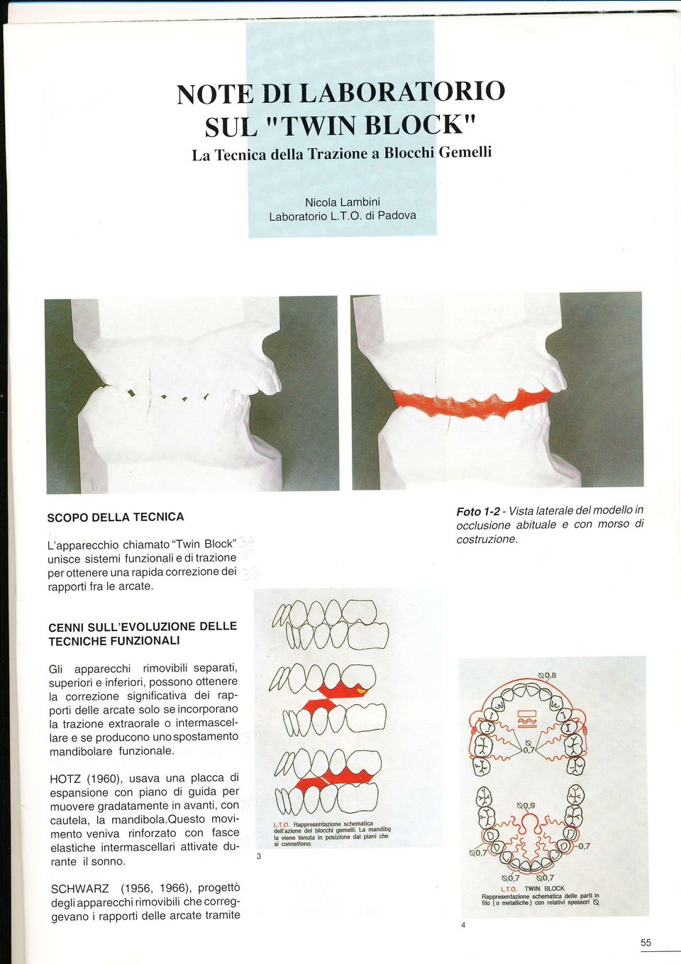 L'apparecchio chiamato "Twin Block" unisce sistemi funzionali e ditrazione per ottenere una rapida correzione dei rapporti fra le arcate.