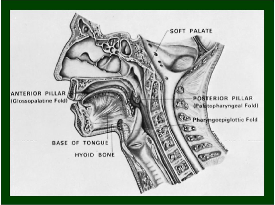 laterali e posteriore) - orofaringe (logge tonsillari, palato molle, base lingua, vallecule glosso -