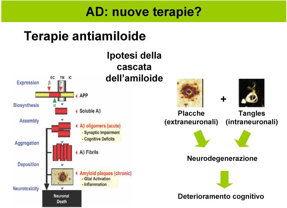 dell amiloide Placche (extraneuronali) +