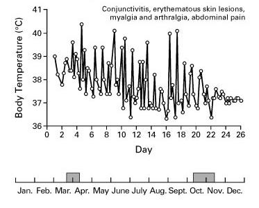 T.R.A.P.S. TNF Receptor Associated Periodic Fever (Febbre Iberniana familiare) Incidenza annuale in Germania: 1/1.785.000 bambini <16 anni.